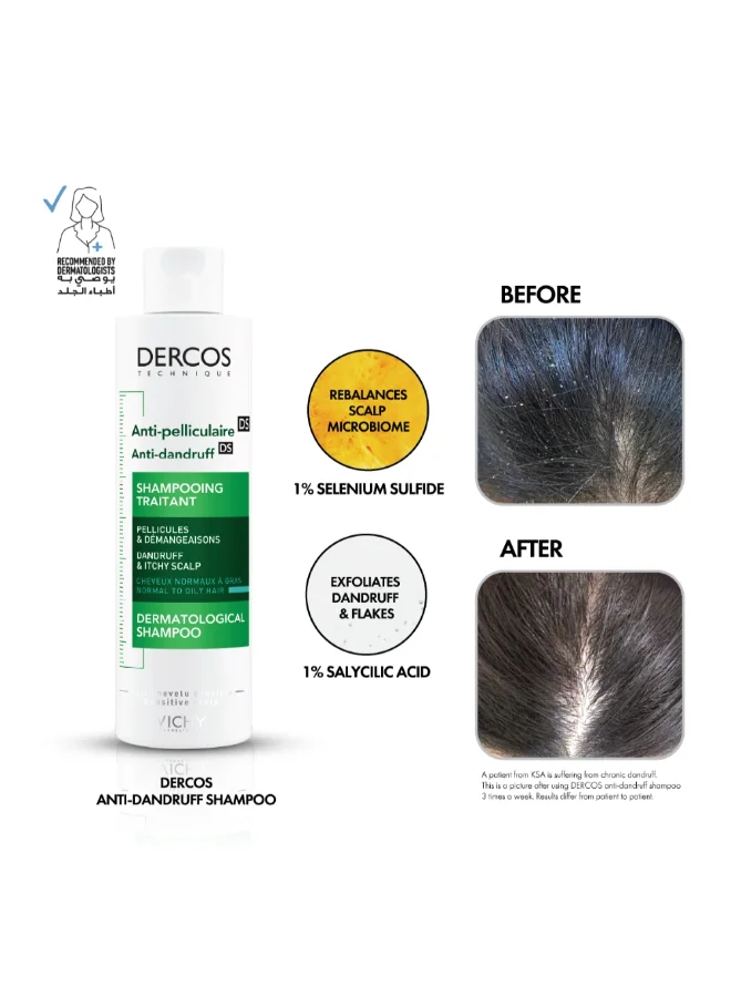 Dercos Shampooing Traitement Anti-Pelliculaire 200ml - Cheveux Normaux à Gras – Image 3